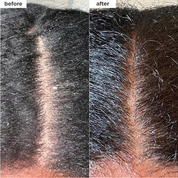 Briogeo Scalp Revival Dandruff Relief Shampoo 248ml