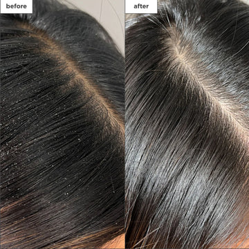 Briogeo Scalp Revival Detox Spray 120ml