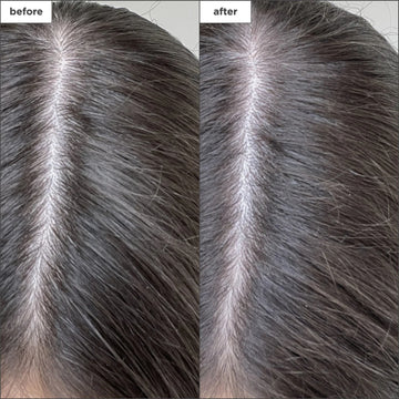 Briogeo Scalp Revival Dry Shampoo 50ml