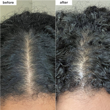 Briogeo Scalp Revival Micro-exfoliating Shampoo 236ml