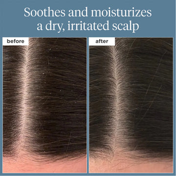 Briogeo Scalp Revival Pre-wash Oil 100ml