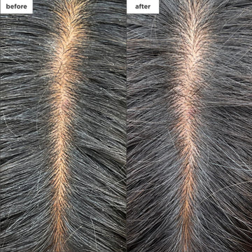 Briogeo Scalp Revival Scalp Mask 177ml
