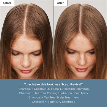 Briogeo Scalp Revival Treatment Drops 30ml